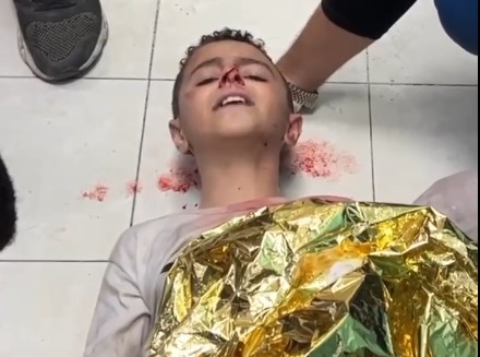 طفل فلسطيني جريح يرتجف بعد وصوله للمستشفى جراء العدوان الصهيوني على غزة