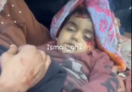 طفل فلسطيني شهيد بعد اصابته جراء العدوان الصهيوني على غزة