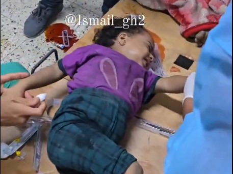 اطفال فلسطينيون مصابون جراء العدوان الصهيوني على غزة