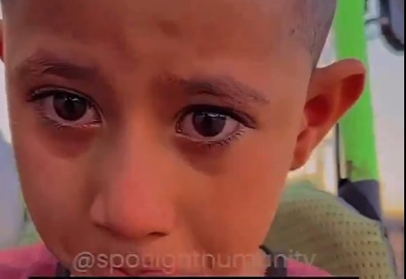طفل فلسطيني يبكي لانه لا يستطيع اللعب مع اخوه بسبب فقدان قدميه جراء العدوان الصهيوني على غزة