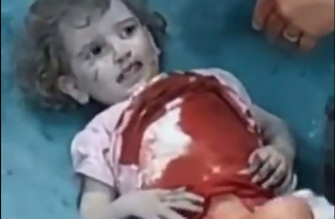 عشرات الشهداء والجرحى الاطفال جراء العدوان الصهيوني على غزة