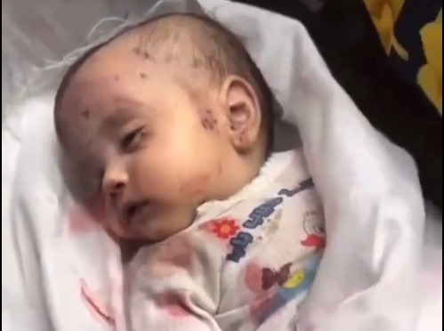 (حبيب بابا) طفل رضيع فلسطيني شهيد بعد اصابته جراء العدوان الصهيوني على غزة