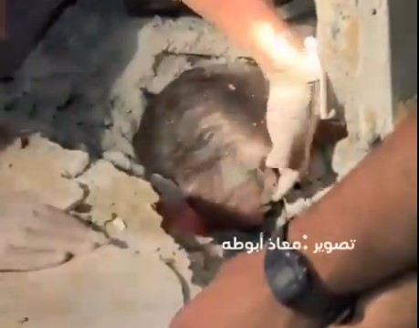 انتشال طفلة فلسطينية حية من تحت ركام منزلها جراء العدوان الصهيوني على غزة